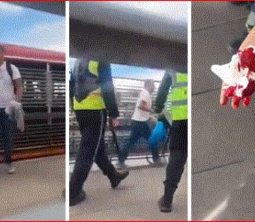 «Un colado, un delincuente»: Brutal ataque con tijera a vigilante en Estación Country Sur de TM