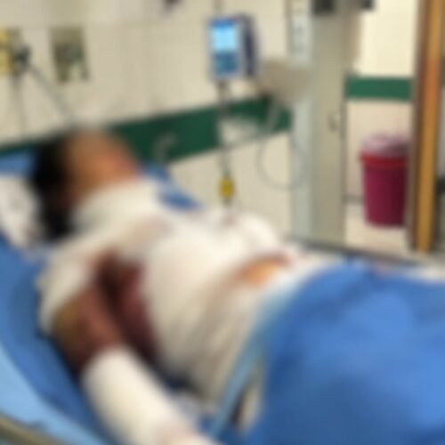 Investigan intento de feminicidio en zona rural del municipio de Buenavista Boyacá